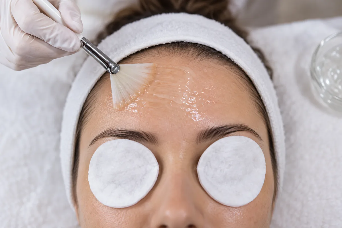 Gel de peeling chimique étalé au pinceau sur le front, yeux protégés par du coton